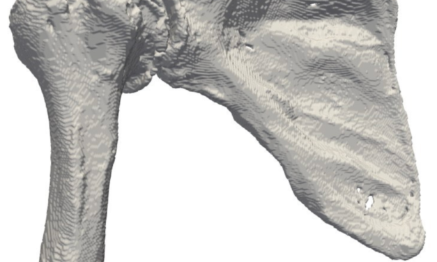 An FDA clearance ≠ “safe” for a NEW total shoulder system.