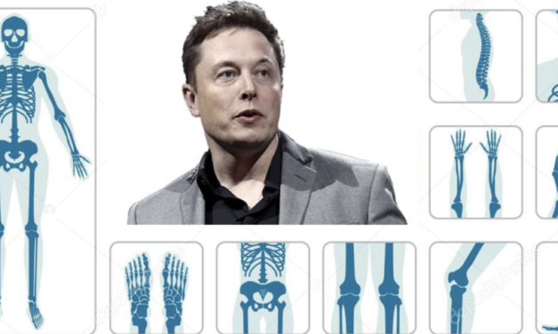 What if Elon Musk built an orthopedic device company?