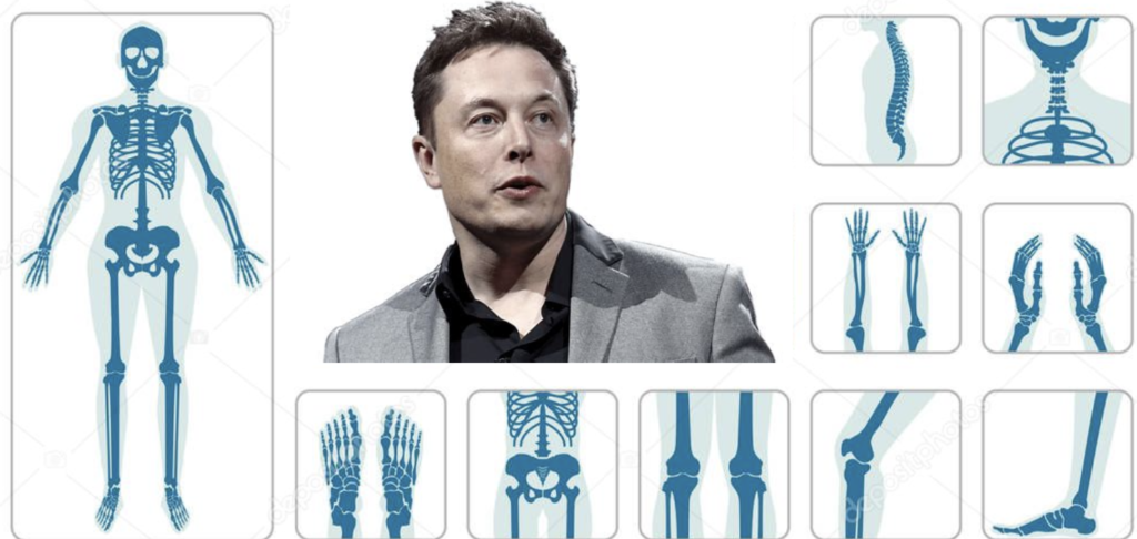 What if Elon Musk built an orthopedic device company?